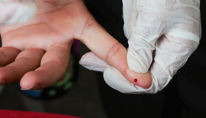  SUS passa a oferecer teste rápido de dengue 